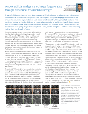 一种用于生成全平面超分辨率 MRI 图像的新型人工智能技术